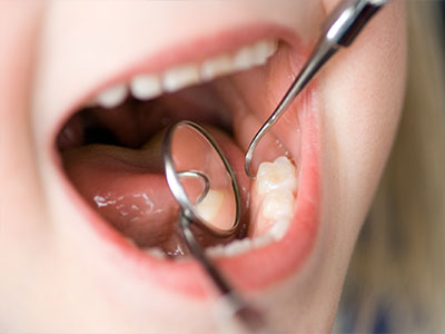 Jerry Ashrafi, DMD, MA PLLC | Restorations  Fillings   Crowns , Infant Oral Exams and Nitrous Oxide